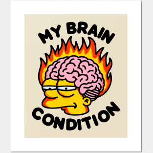 My Brain Condition Posters and Art